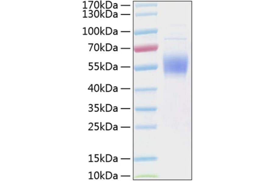 SDS-PAGE - Recombinant Human IL3RA/CD123 Protein (C-terminal His Tag) (A330904) - Antibodies.com