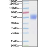 SDS-PAGE - Recombinant Human IL3RA/CD123 Protein (C-terminal His Tag) (A330904) - Antibodies.com