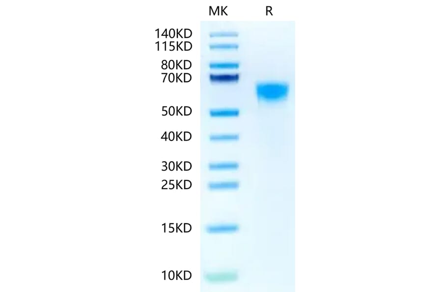 Tris-Bis PAGE - Recombinant Human IL3RA/CD123 Protein (Biotin) (C-terminal His and Avi Tag) (A330905) - Antibodies.com