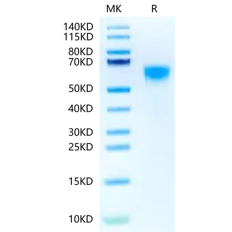 Tris-Bis PAGE - Recombinant Human IL3RA/CD123 Protein (Biotin) (C-terminal His and Avi Tag) (A330905) - Antibodies.com
