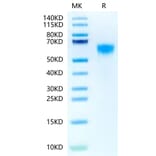 Tris-Bis PAGE - Recombinant Human IL3RA/CD123 Protein (Biotin) (C-terminal His and Avi Tag) (A330905) - Antibodies.com