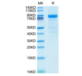 Tris-Bis PAGE - Recombinant Human IL3RA/CD123 Protein (C-terminal Human Fc Tag) (A330906) - Antibodies.com