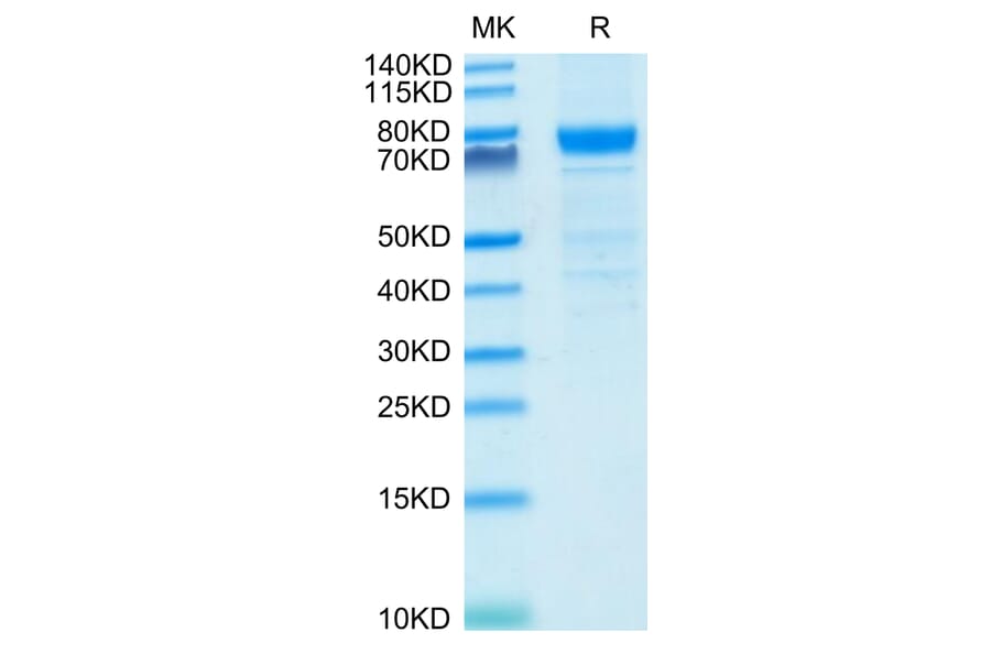 Tris-Bis PAGE - Recombinant Human IL3RA/CD123 Protein (C-terminal Human Fc Tag) (A330906) - Antibodies.com