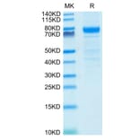 Tris-Bis PAGE - Recombinant Human IL3RA/CD123 Protein (C-terminal Human Fc Tag) (A330906) - Antibodies.com