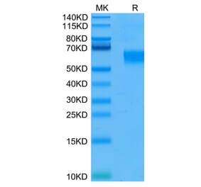 Tris-Bis PAGE - Recombinant Human IL3RA/CD123 Protein (C-terminal His Tag) (A330907) - Antibodies.com