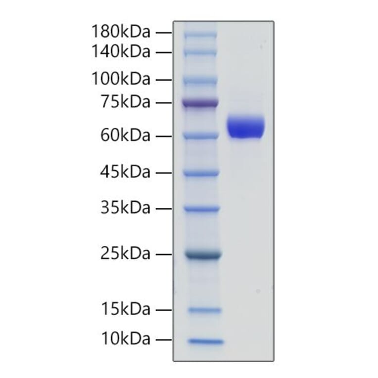SDS-PAGE - Recombinant Human IL-3RB Protein (C-terminal His Tag) (A330908) - Antibodies.com