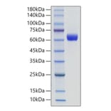 SDS-PAGE - Recombinant Human IL-3RB Protein (C-terminal His Tag) (A330908) - Antibodies.com