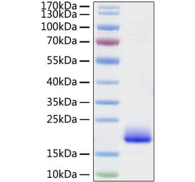 SDS-PAGE - Recombinant Mouse IL-4 Protein (C-terminal His Tag) (A330909) - Antibodies.com