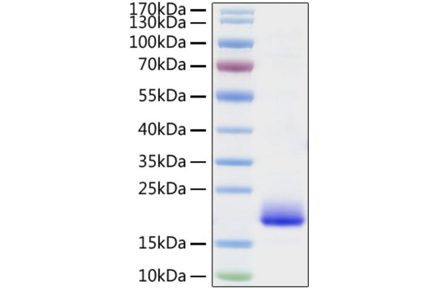 SDS-PAGE - Recombinant Mouse IL-4 Protein (C-terminal His Tag) (A330909) - Antibodies.com