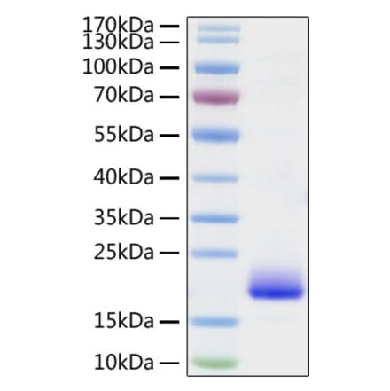 SDS-PAGE - Recombinant Mouse IL-4 Protein (C-terminal His Tag) (A330909) - Antibodies.com