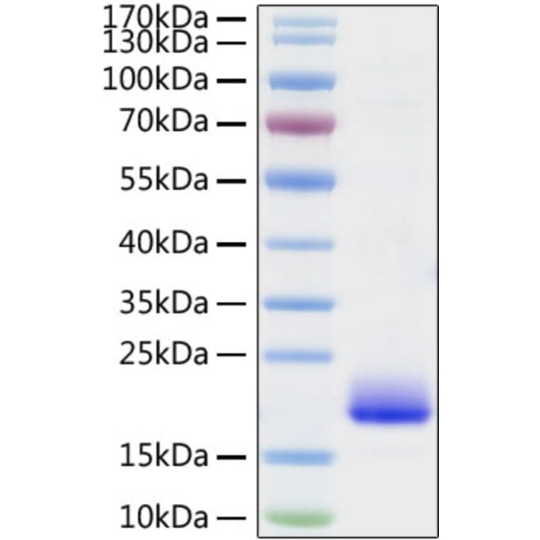 SDS-PAGE - Recombinant Mouse IL-4 Protein (C-terminal His Tag) (A330909) - Antibodies.com