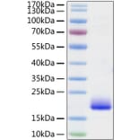 SDS-PAGE - Recombinant Mouse IL-4 Protein (C-terminal His Tag) (A330909) - Antibodies.com
