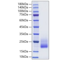 SDS-PAGE - Recombinant Rat IL-4 Protein (C-terminal His Tag) (A330910) - Antibodies.com