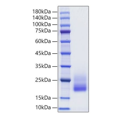 SDS-PAGE - Recombinant Rat IL-4 Protein (C-terminal His Tag) (A330910) - Antibodies.com
