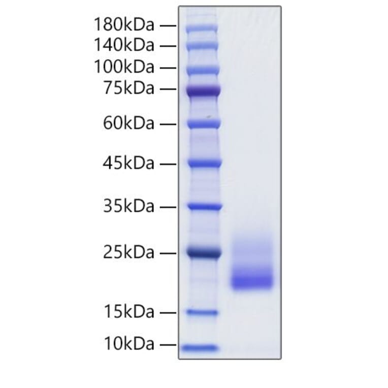 SDS-PAGE - Recombinant Rat IL-4 Protein (C-terminal His Tag) (A330910) - Antibodies.com