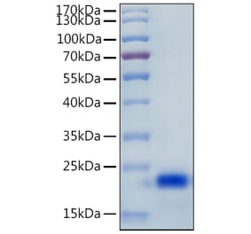 SDS-PAGE - Recombinant Human IL-4 Protein (C-terminal His Tag) (A330911) - Antibodies.com