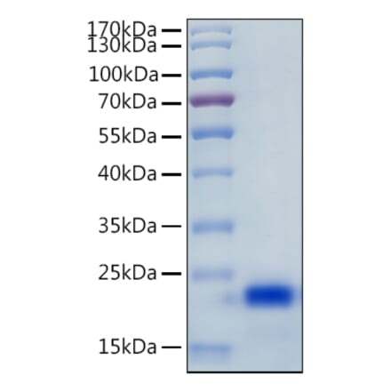 SDS-PAGE - Recombinant Human IL-4 Protein (C-terminal His Tag) (A330911) - Antibodies.com