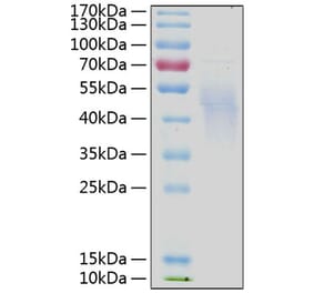 SDS-PAGE - Recombinant Human IL-4R Protein (C-terminal His Tag) (A330912) - Antibodies.com
