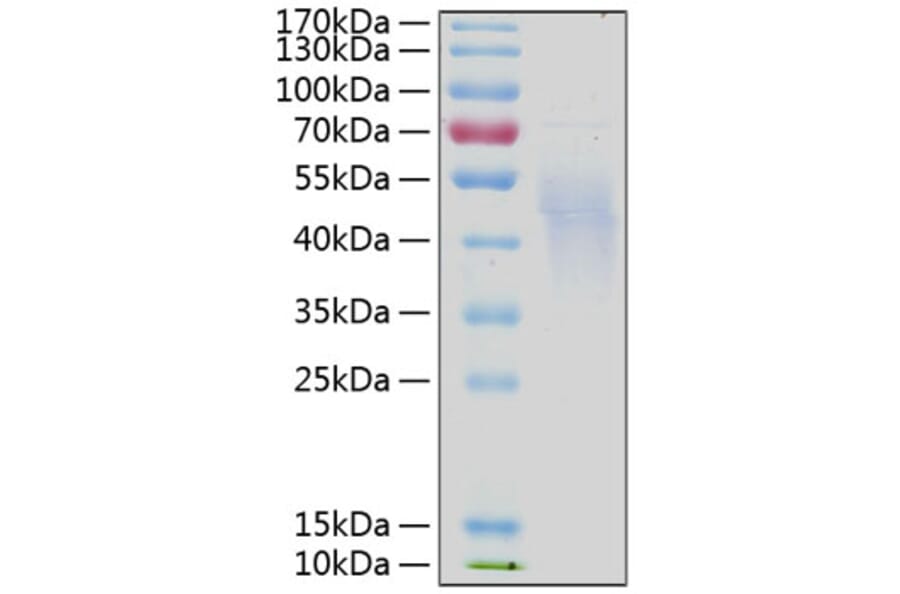 SDS-PAGE - Recombinant Human IL-4R Protein (C-terminal His Tag) (A330912) - Antibodies.com