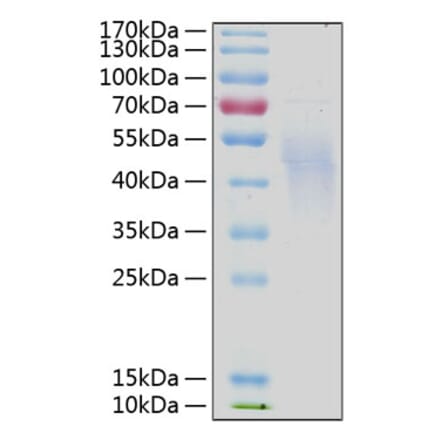 SDS-PAGE - Recombinant Human IL-4R Protein (C-terminal His Tag) (A330912) - Antibodies.com