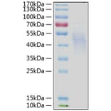 SDS-PAGE - Recombinant Human IL-4R Protein (C-terminal His Tag) (A330912) - Antibodies.com
