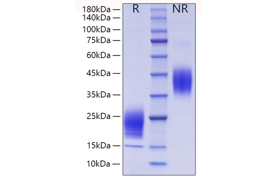 SDS-PAGE - Recombinant Mouse IL-5 Protein (C-terminal His Tag) (A330913) - Antibodies.com