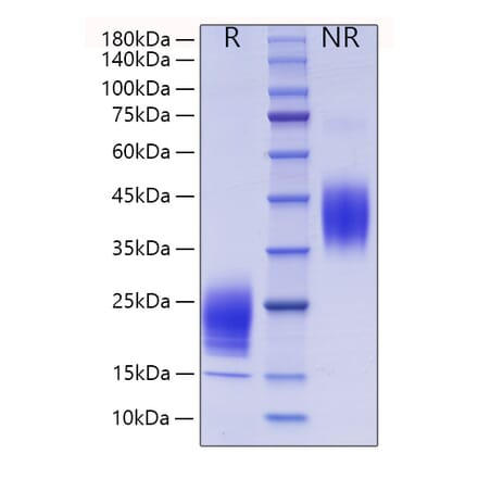 SDS-PAGE - Recombinant Mouse IL-5 Protein (C-terminal His Tag) (A330913) - Antibodies.com