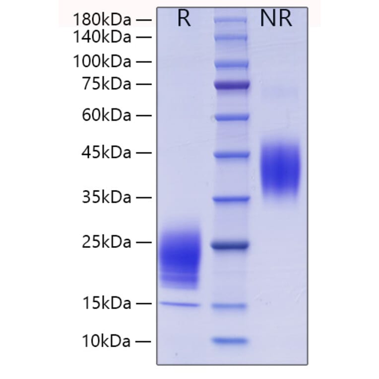 SDS-PAGE - Recombinant Mouse IL-5 Protein (C-terminal His Tag) (A330913) - Antibodies.com
