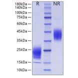 SDS-PAGE - Recombinant Mouse IL-5 Protein (C-terminal His Tag) (A330913) - Antibodies.com