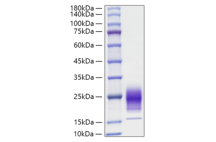 SDS-PAGE - Recombinant Rat IL-5 Protein (C-terminal His Tag) (A330914) - Antibodies.com