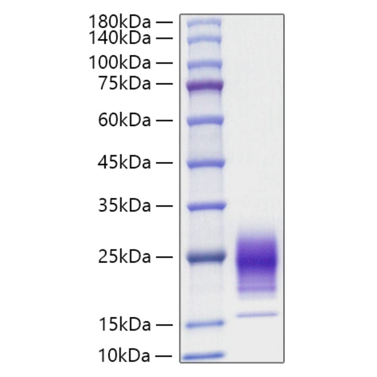 SDS-PAGE - Recombinant Rat IL-5 Protein (C-terminal His Tag) (A330914) - Antibodies.com
