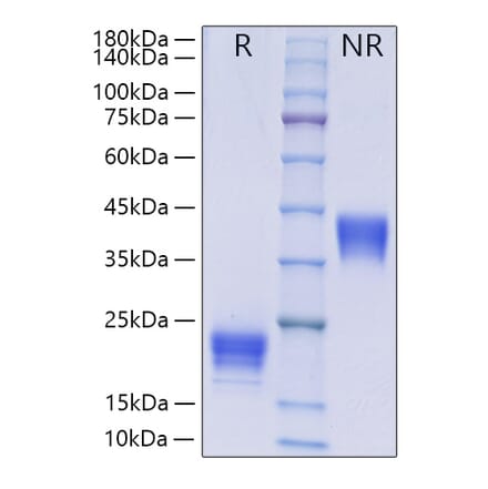 SDS-PAGE - Recombinant Human IL-5 Protein (C-terminal His Tag) (A330915) - Antibodies.com