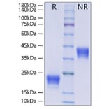 SDS-PAGE - Recombinant Human IL-5 Protein (C-terminal His Tag) (A330915) - Antibodies.com