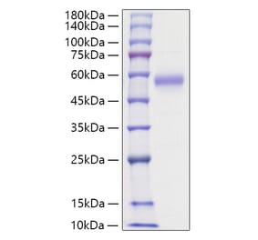 SDS-PAGE - Recombinant Human IL5RA Protein (C-terminal His Tag) (A330916) - Antibodies.com