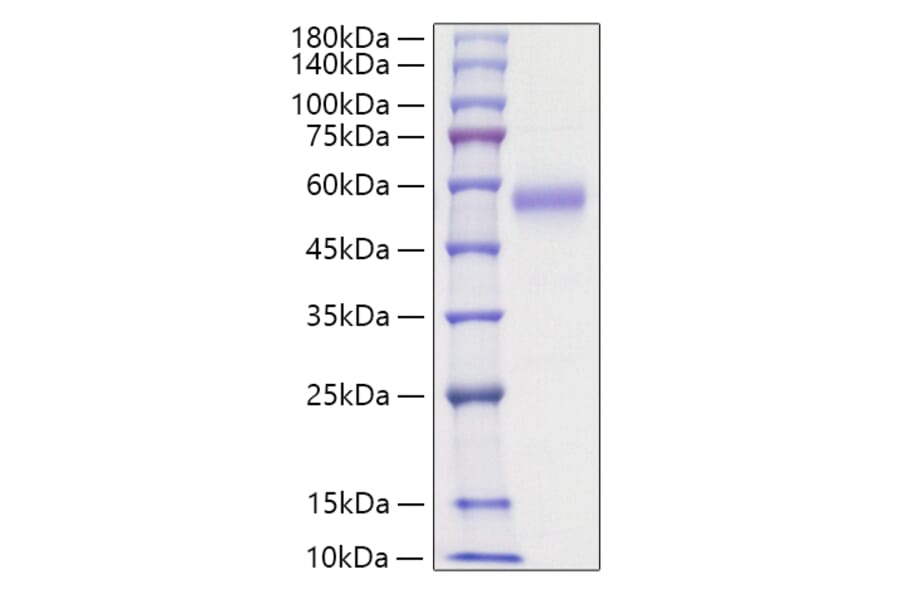 SDS-PAGE - Recombinant Human IL5RA Protein (C-terminal His Tag) (A330916) - Antibodies.com