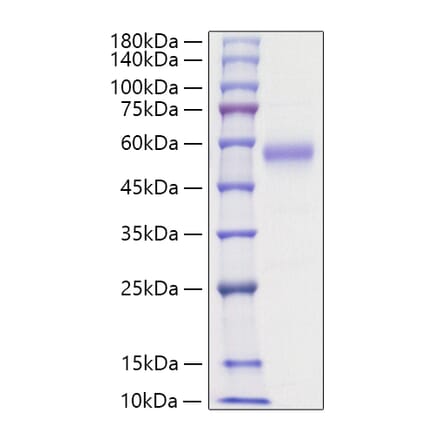 SDS-PAGE - Recombinant Human IL5RA Protein (C-terminal His Tag) (A330916) - Antibodies.com