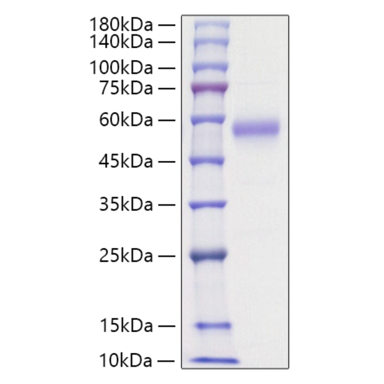SDS-PAGE - Recombinant Human IL5RA Protein (C-terminal His Tag) (A330916) - Antibodies.com