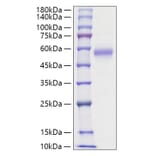 SDS-PAGE - Recombinant Human IL5RA Protein (C-terminal His Tag) (A330916) - Antibodies.com