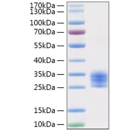 SDS-PAGE - Recombinant Mouse IL-6 Protein (C-terminal His Tag) (A330917) - Antibodies.com