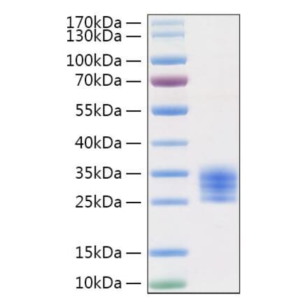 SDS-PAGE - Recombinant Mouse IL-6 Protein (C-terminal His Tag) (A330917) - Antibodies.com