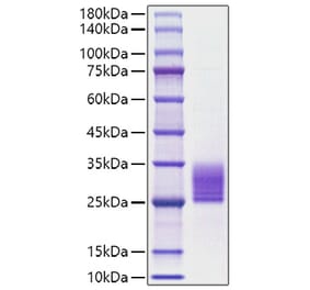 SDS-PAGE - Recombinant Rat IL-6 Protein (C-terminal His Tag) (A330918) - Antibodies.com