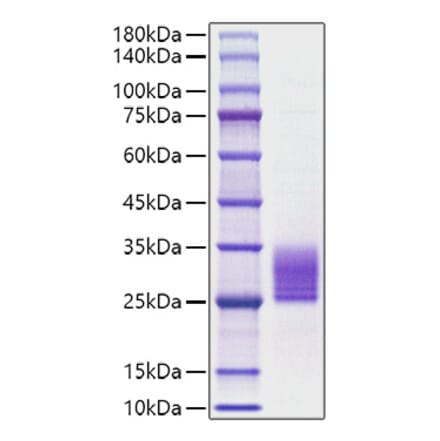 SDS-PAGE - Recombinant Rat IL-6 Protein (C-terminal His Tag) (A330918) - Antibodies.com