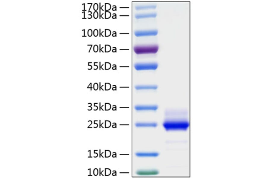 SDS-PAGE - Recombinant Human IL-6 Protein (C-terminal His Tag) (A330919) - Antibodies.com