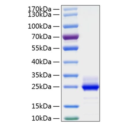 SDS-PAGE - Recombinant Human IL-6 Protein (C-terminal His Tag) (A330919) - Antibodies.com