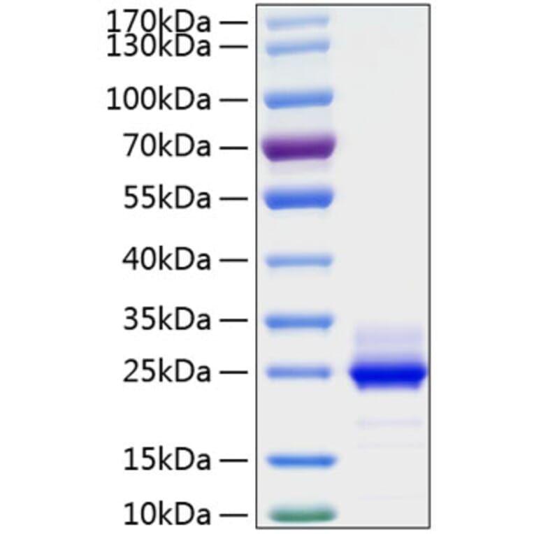 SDS-PAGE - Recombinant Human IL-6 Protein (C-terminal His Tag) (A330919) - Antibodies.com