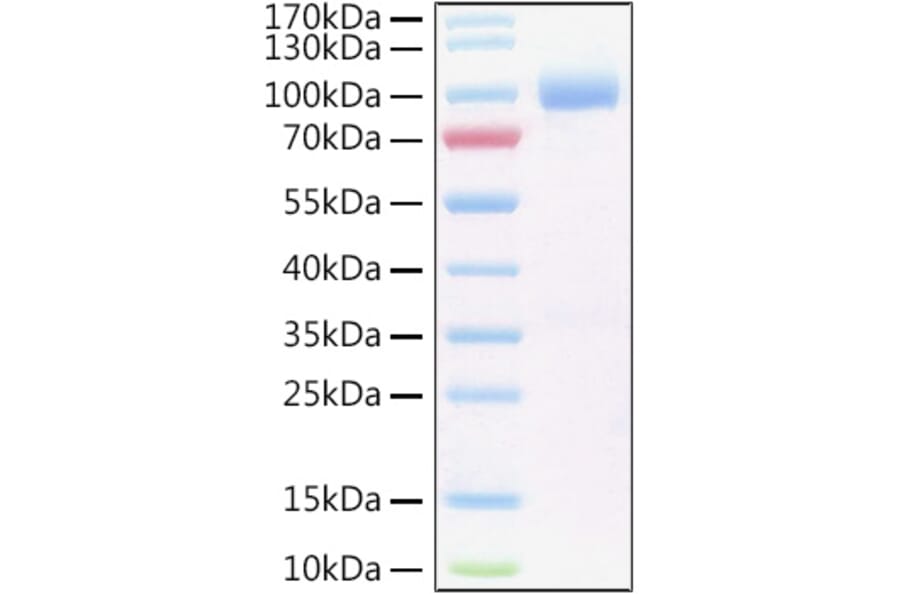 SDS-PAGE - Recombinant Human IL-6R Protein (C-terminal Human Fc and His Tag) (A330920) - Antibodies.com