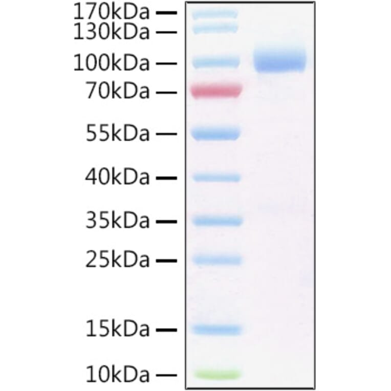 SDS-PAGE - Recombinant Human IL-6R Protein (C-terminal Human Fc and His Tag) (A330920) - Antibodies.com