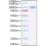 SDS-PAGE - Recombinant Human IL-6R Protein (C-terminal Human Fc and His Tag) (A330920) - Antibodies.com