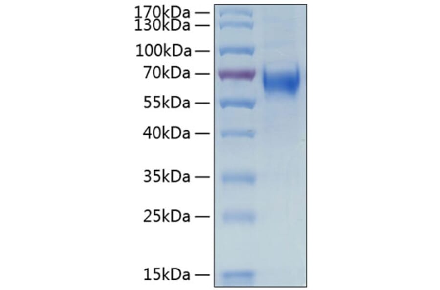 SDS-PAGE - Recombinant Human IL-6R Protein (C-terminal His Tag) (A330921) - Antibodies.com