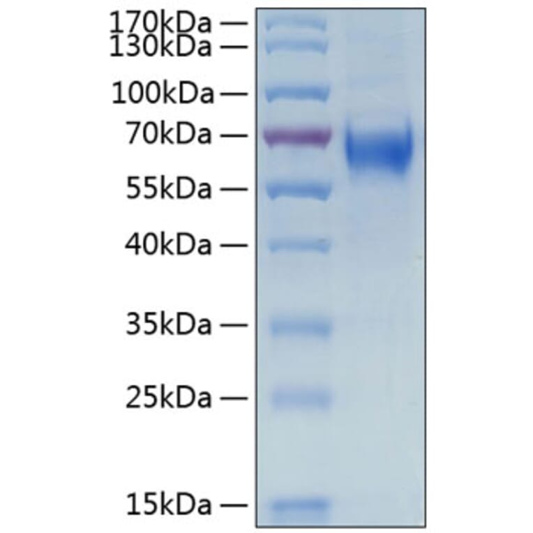 SDS-PAGE - Recombinant Human IL-6R Protein (C-terminal His Tag) (A330921) - Antibodies.com